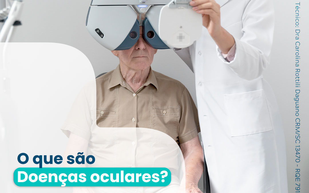 Doenças oculares: o que são e como identificar?